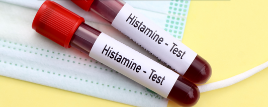 How to Flush Out Histamine